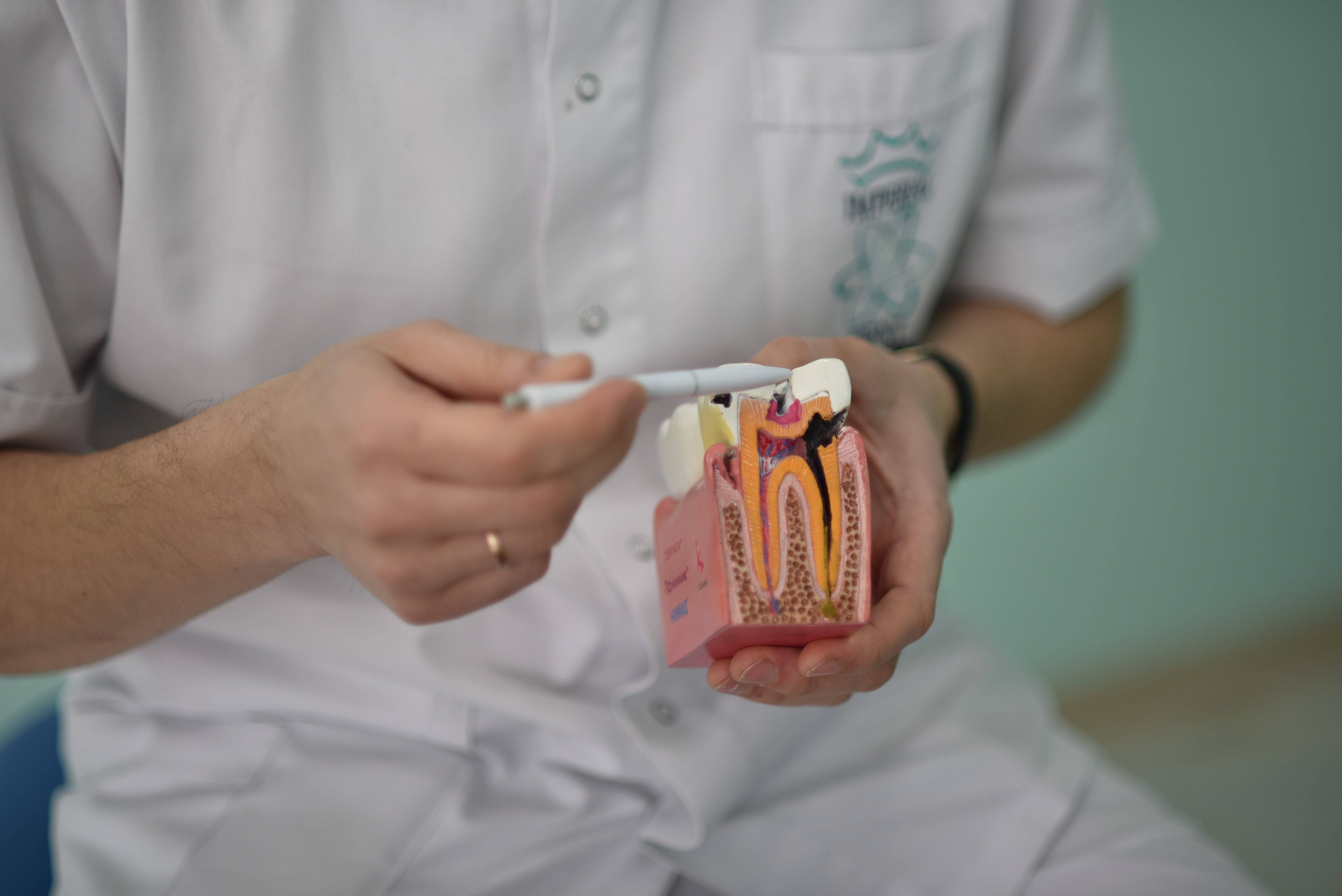 tratament carii chisinau stomatolog explica pe macheta tratament de canal